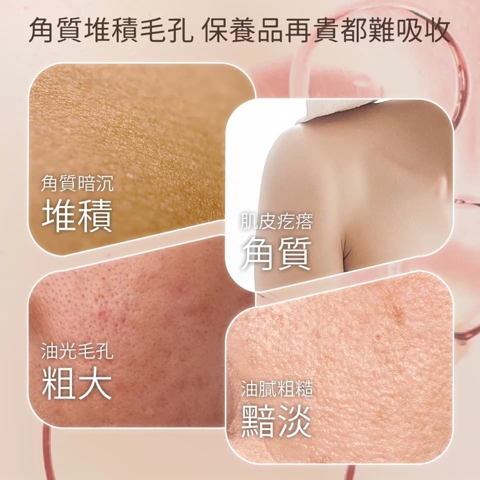 【澳思萊AUS LIFE】玫瑰果拋光去角質凝膠 260ml 縮圖 5