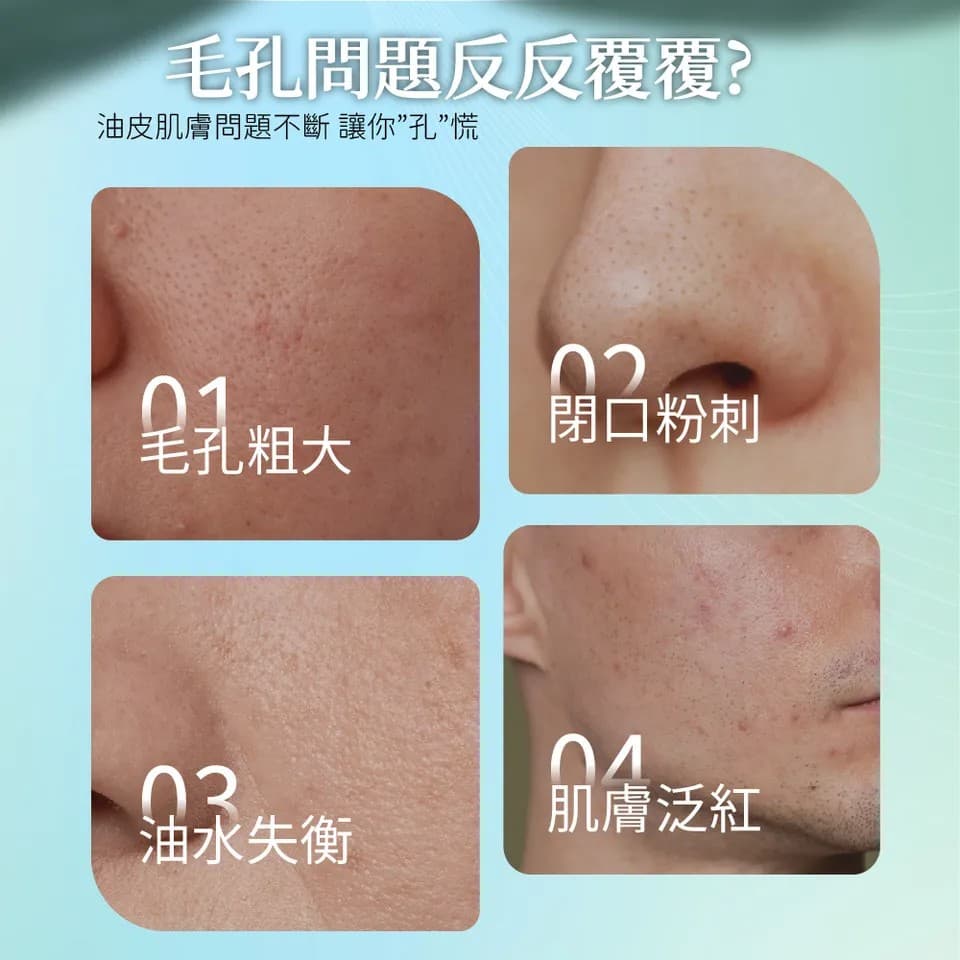 【澳思萊AUS LIFE】茶樹調理淨化化妝水 140ml 縮圖 5
