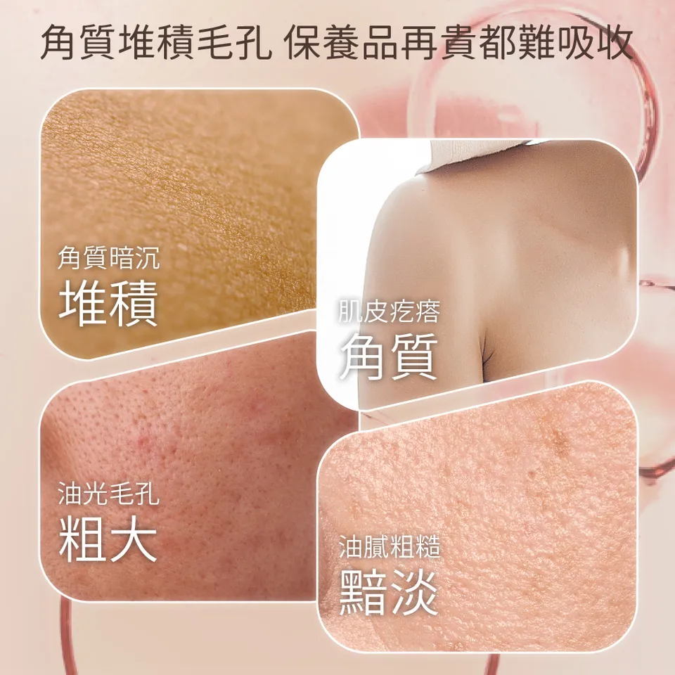 【澳思萊AUS LIFE】玫瑰果拋光去角質凝膠 260ml 圖 6