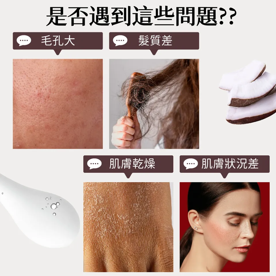 【澳維花園Aus Garden】頂級分餾椰子油 100ml 圖 4